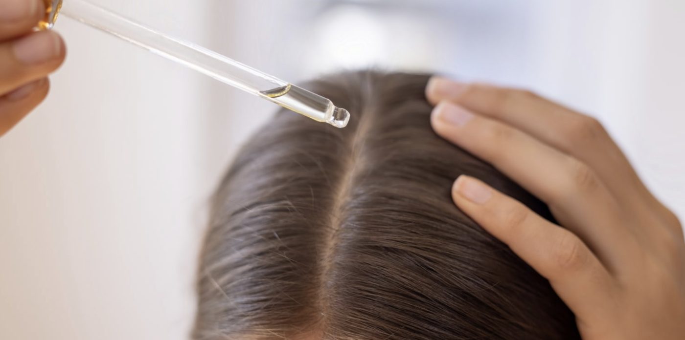 A dropper releasing oil onto the part of the scalp, held open by hand